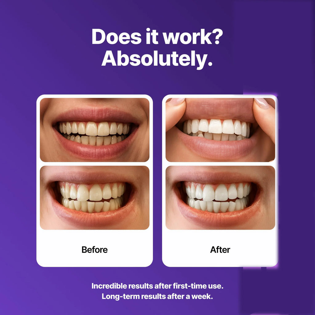 Dr Dent Teeth Whitening Strips